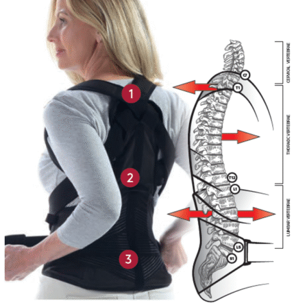 Tutore Donjoy Osteostrap 8 Tutore Donjoy Osteostrap - immagine 4