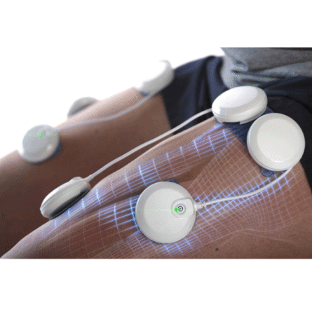 Chattanooga Wireless Pro 2 canali Elettrostimolatore - immagine 4